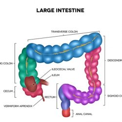 Colon colonoscopy cancer do prepare slide understanding sigmoid show choose board module preparing