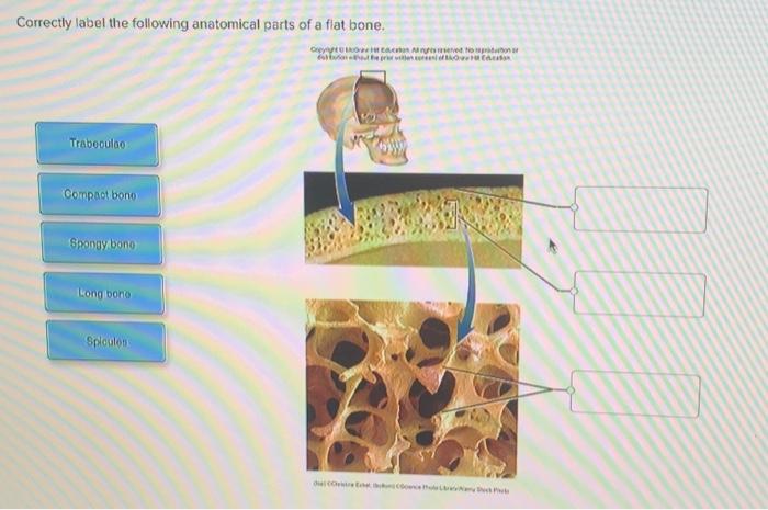 Correctly label the following anatomical parts of a flat bone