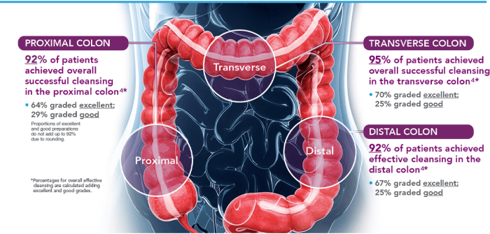 Correctly label the following parts of the large intestine.